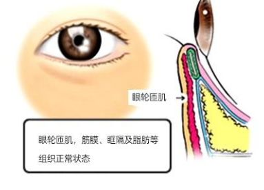 眼袋