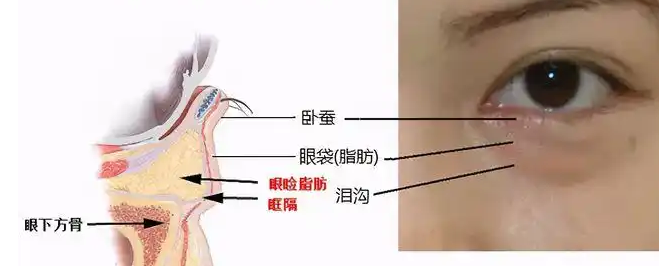 眼袋