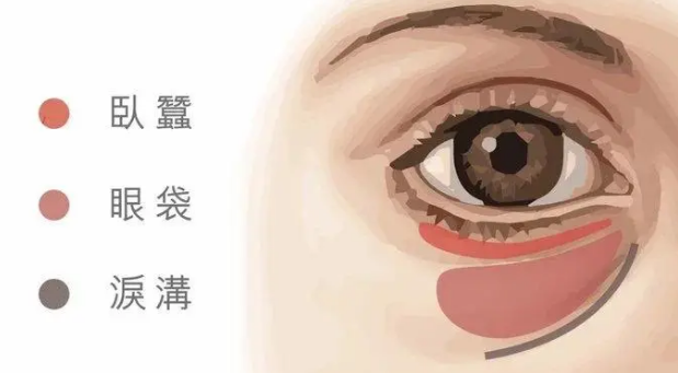去眼袋手术