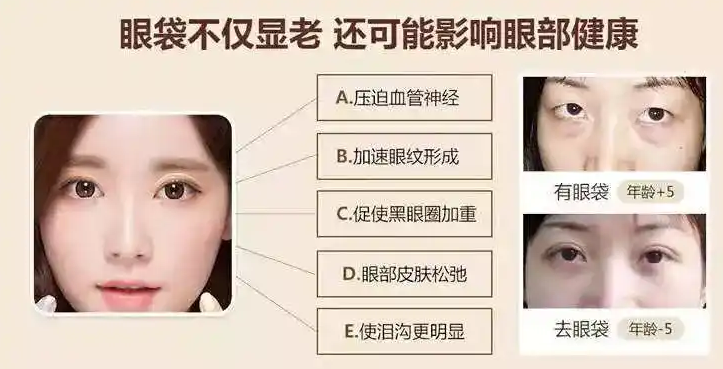 去眼袋手术