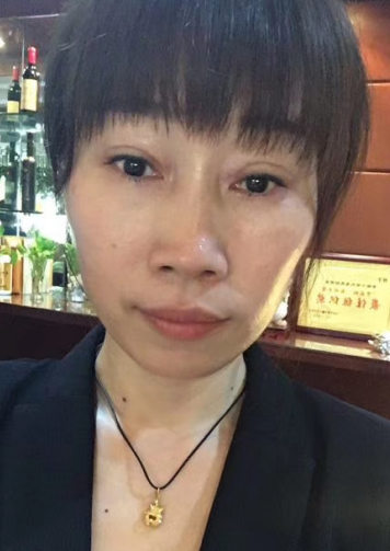 去眼袋手术