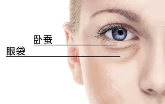 去眼袋手术