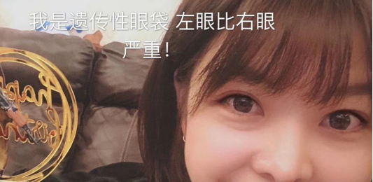 去眼袋手术