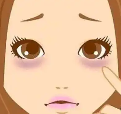 去眼袋手术