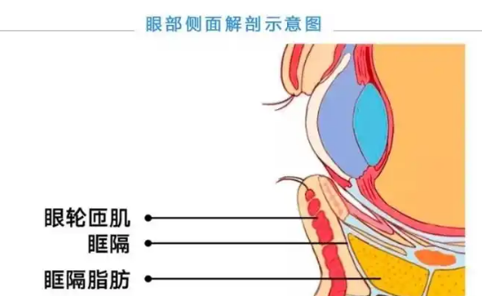 去眼袋手术