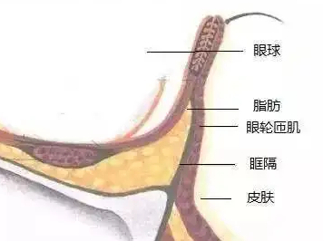 去眼袋手术