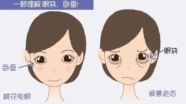 去眼袋手术