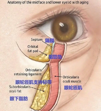 去眼袋手术