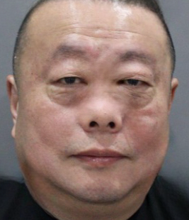 去眼袋手术