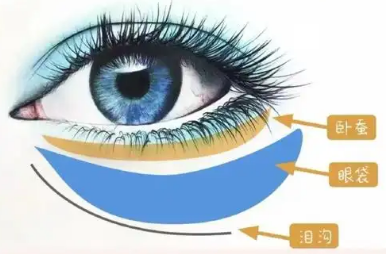 去眼袋手术