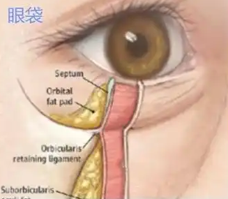去眼袋手术
