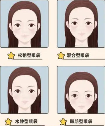 去眼袋手术
