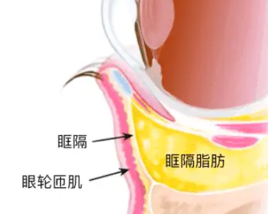 去眼袋手术