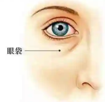 去眼袋手术