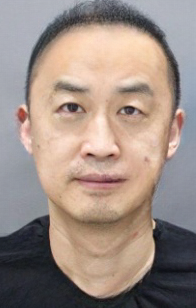 去眼袋手术