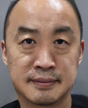 去眼袋手术