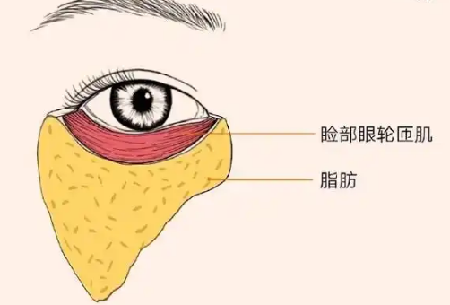 去眼袋手术