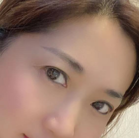 去眼袋手术