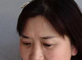 去眼袋手术