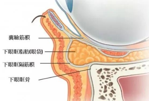 去眼袋手术
