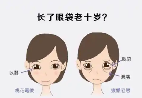 去眼袋手术