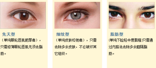 去眼袋手术