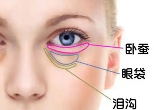 去眼袋手术