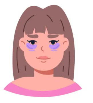 去眼袋手术