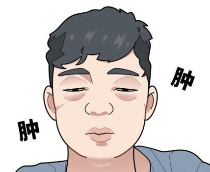 去眼袋手术