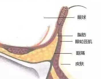 去眼袋手术