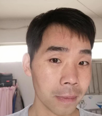 去眼袋手术