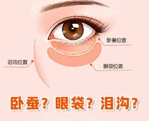 去眼袋手术