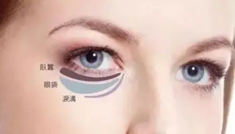 眼袋