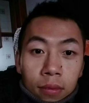 去眼袋手术