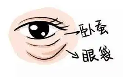 去眼袋手术