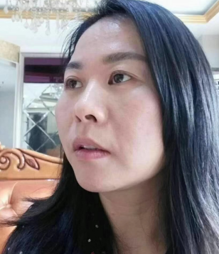 去眼袋手术