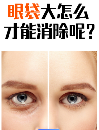 去眼袋手术