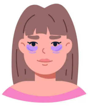 去眼袋手术