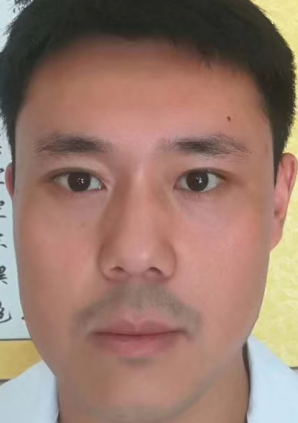 去眼袋手术
