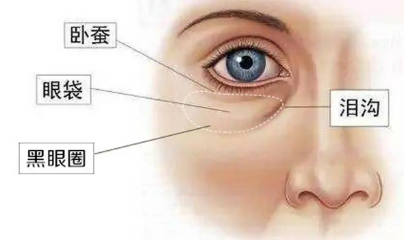 去眼袋手术