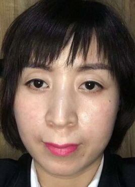 去眼袋手术