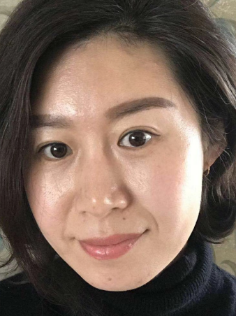去眼袋手术