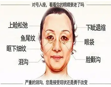 去眼袋手术