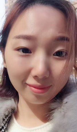 去眼袋手术