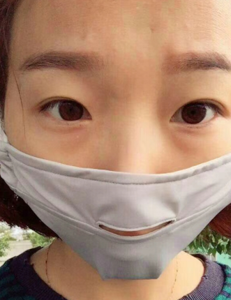 去眼袋手术