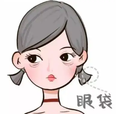 手术去眼袋