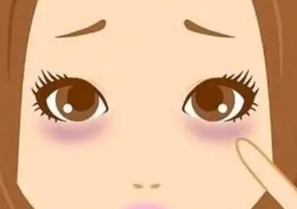去眼袋手术