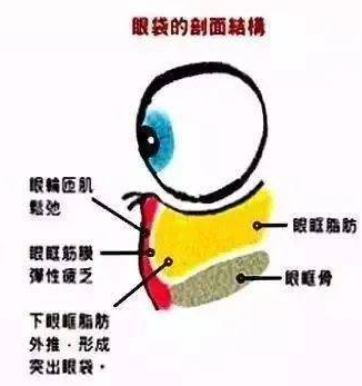 去眼袋手术