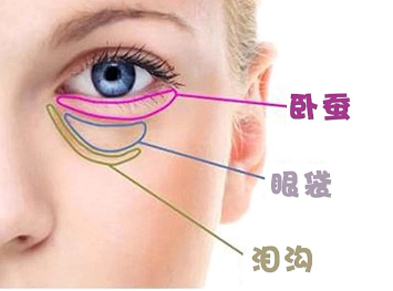 眼袋
