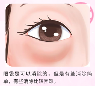 去眼袋手术